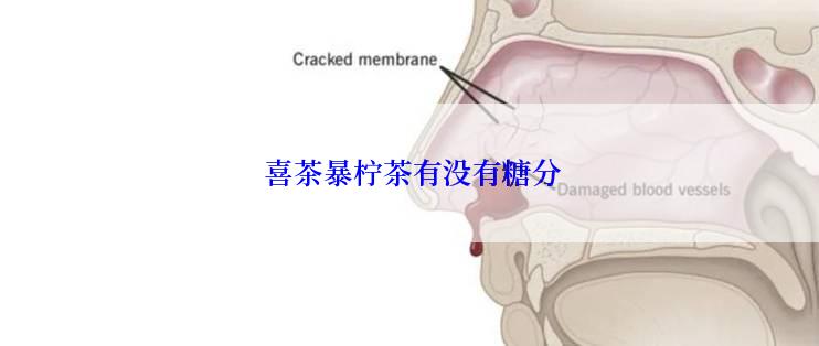  喜茶暴柠茶有没有糖分